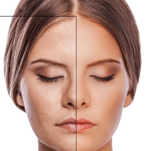 VI Peel medical spa clearwater